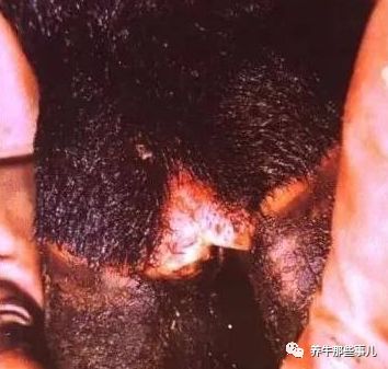 口蹄疫3天病死7头牛怎么治疗