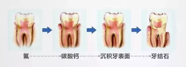 澳洲蜂胶牙膏哪个品牌好,国外去牙黄最有效的牙膏