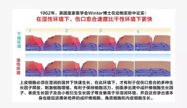 比创可贴好用,最好用的液体创可贴