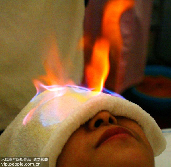 中医火疗全过程,中医神奇火针治疑难病