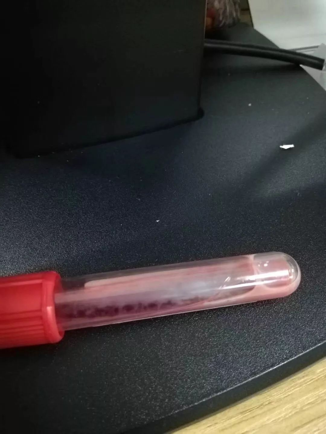 怀胎32周孕妇突发腹疼，抽血检查发现半管都是油脂……医生都惊呆了