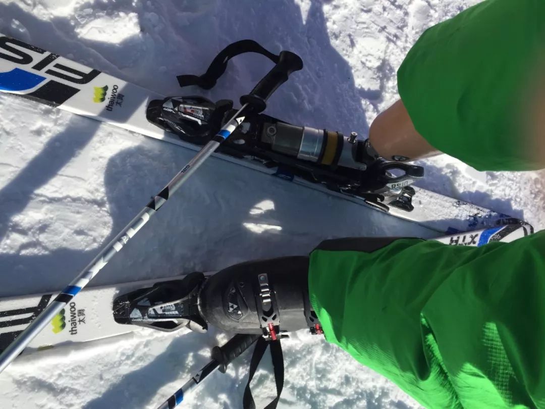 俄罗斯留学生骨折截肢,留学生意外被截肢