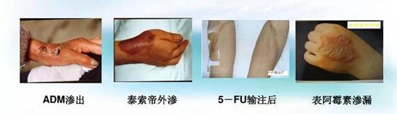 picc置管后我该如何维护,picc置管术后期维护要多少钱