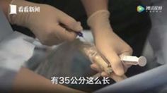 未婚女孩捐一次卵有危害吗,女性捐卵子对身体有伤害吗