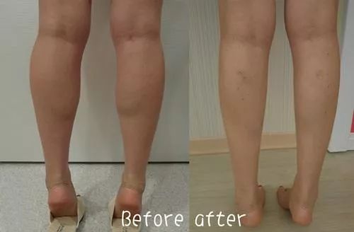 经络刷瘦身教程,经络刷减肥瘦肚子按摩手法