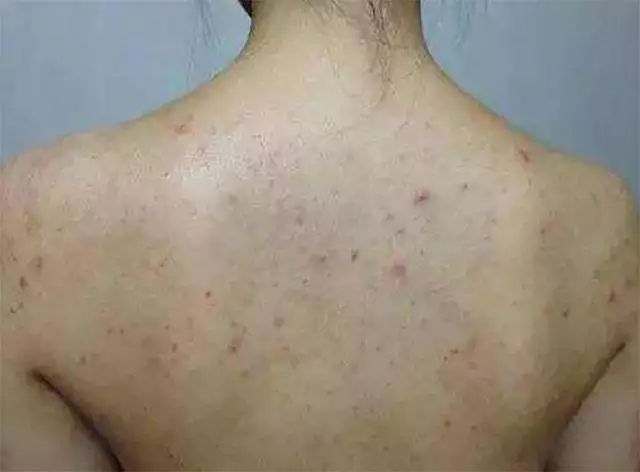 经络刷瘦身教程,经络刷减肥瘦肚子按摩手法