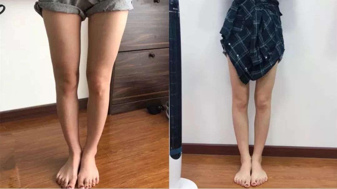 同样是减肥你为什么瘦不下来,同样是减肥为什么你减肥那么慢