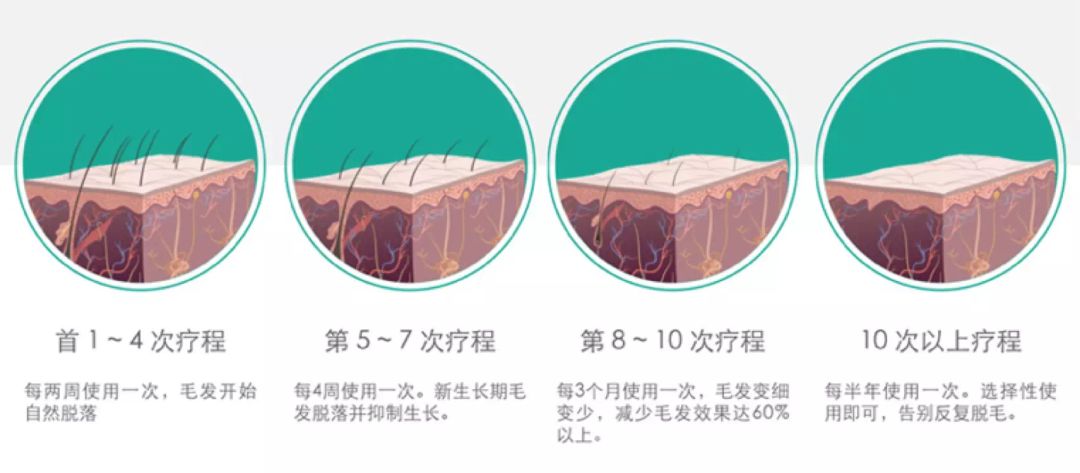 有什么办法脱毛之后不再长,怎样脱毛不再长最有效方法