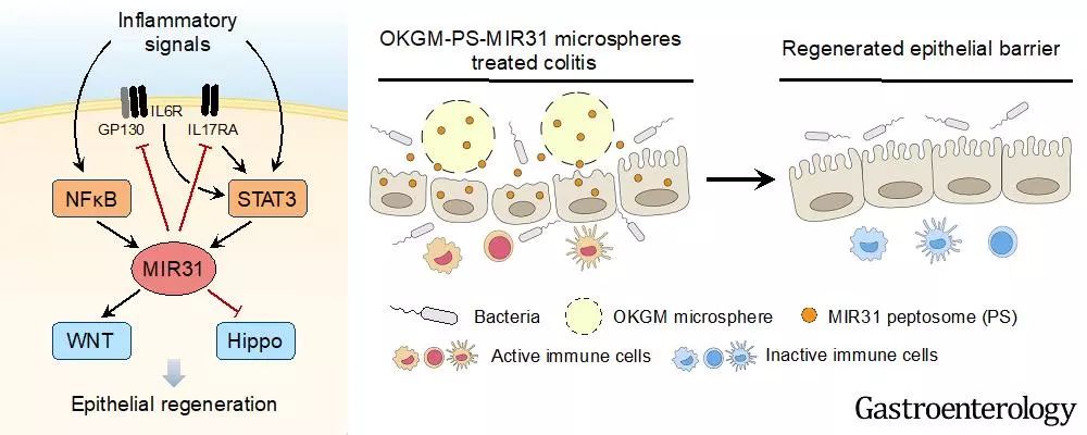 溃疡性结肠炎最新研究成果,研究发现改善肠道炎症
