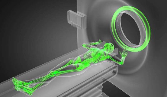 核磁共振对人体的副作用有哪些,核磁共振增强伤身体吗
