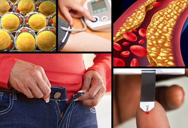 代谢综合征,代谢综合征通过运动能治愈吗