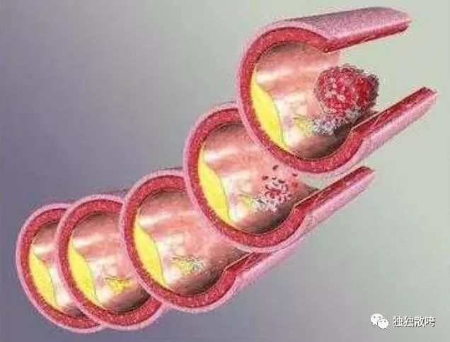 解密慢病真相,医生都解释不了的事情