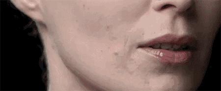 女子砸3万做“线雕”美容，却被打了这个针！更气人的是……