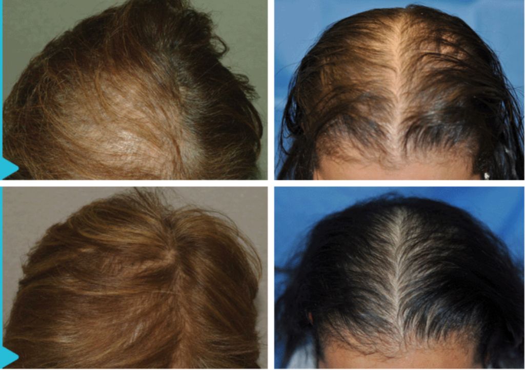 想为颜值偷偷加分？但只有10%的人会机智地修饰这里诶！