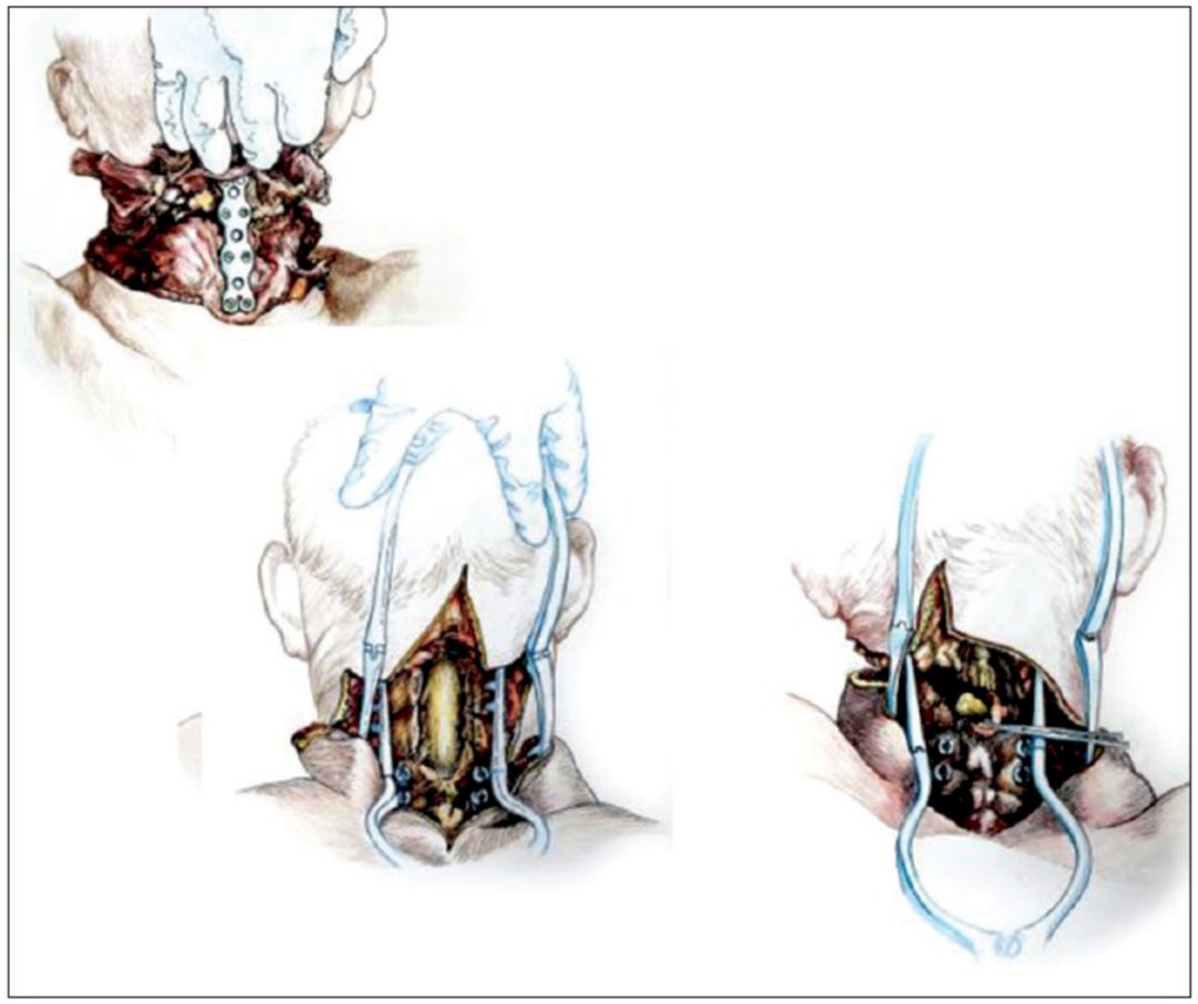 杨永信被送进戒网瘾学校,被杨永信戒断网瘾的孩子