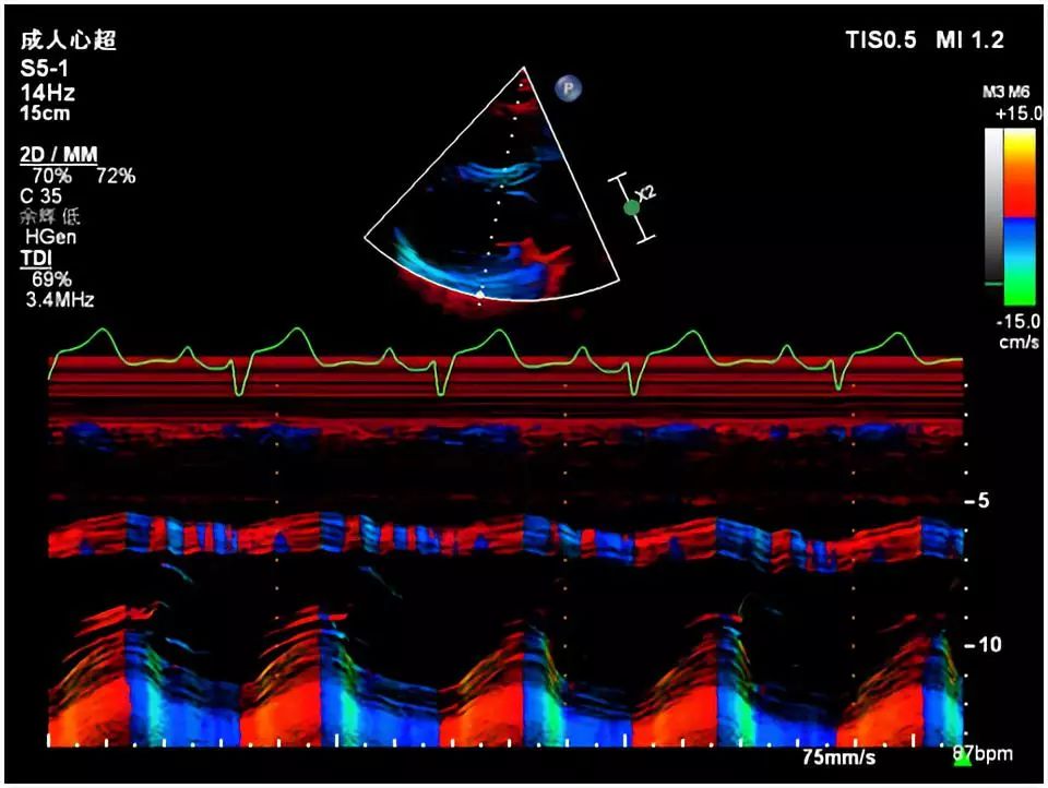 心动在线怎么没有了,心动在线观看