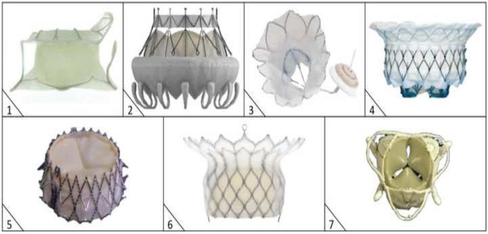 经导管瓣膜修复术费用,经导管瓣膜植入术风险