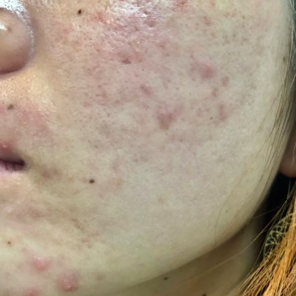 一洗就白的洗面奶火山泥,火山泥洗面奶真的能变白吗