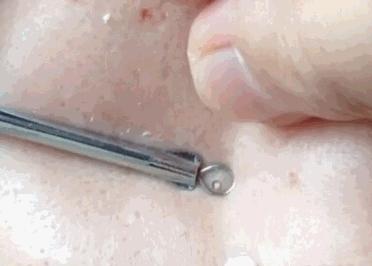 辣眼睛，有人用它吸出一整年的黑头，看完我果断下单了！