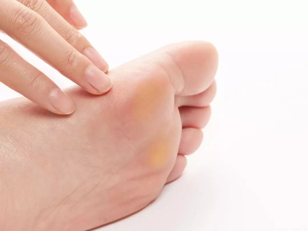 一条拼团丨10分钟，双脚轻松变光滑