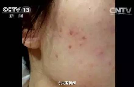 你以为网淘代购的奢侈品都是真的吗？看了这个就全明白了！丨天天315