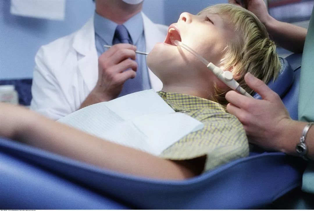 苏州口腔医院补牙,苏州补一颗牙齿需要多久