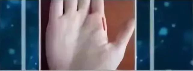 手上突然有青筋是什么原因,突然看到手上有青筋什么原因