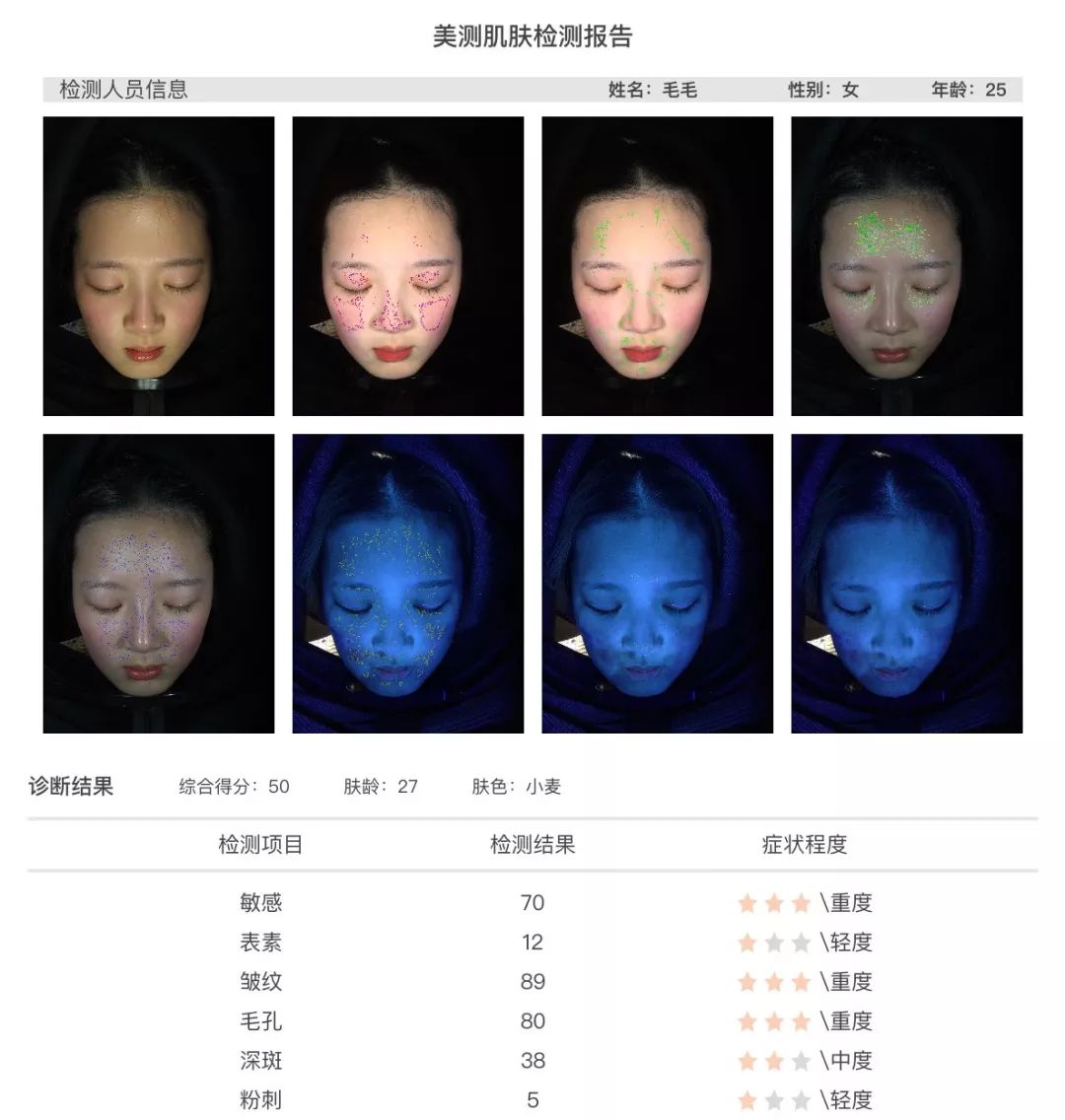 小茂肌诊室到底有多强,小茂肌诊室皮肤状态