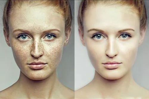 晒斑痘印去除土方法,5个祛斑小妙招淡化晒斑雀斑痘印