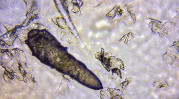 皮肤清洁出黑色的东西,皮肤挤出白色膏状很臭怎么办