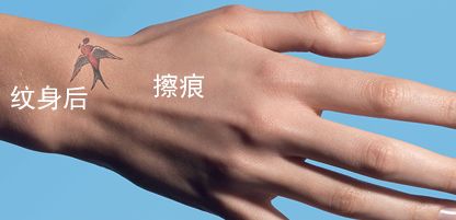 痘印红血丝修复护肤品平价,痘印泛红团购