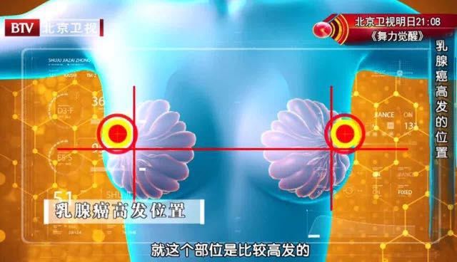 乳腺癌宫颈癌哪个严重,女性乳腺癌宫颈癌哪个发病率高