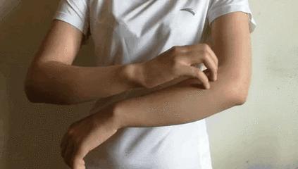 挤痘痘出来的白色长条状是什么,痘痘黑头挤出白颗粒