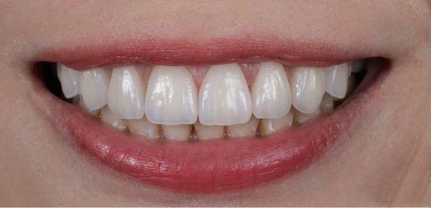 美丽从齿开始口腔诊所天津,美丽从牙开始的图片