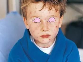 春天幼儿出疹怎么治,孩子出疹与季节有关的情况