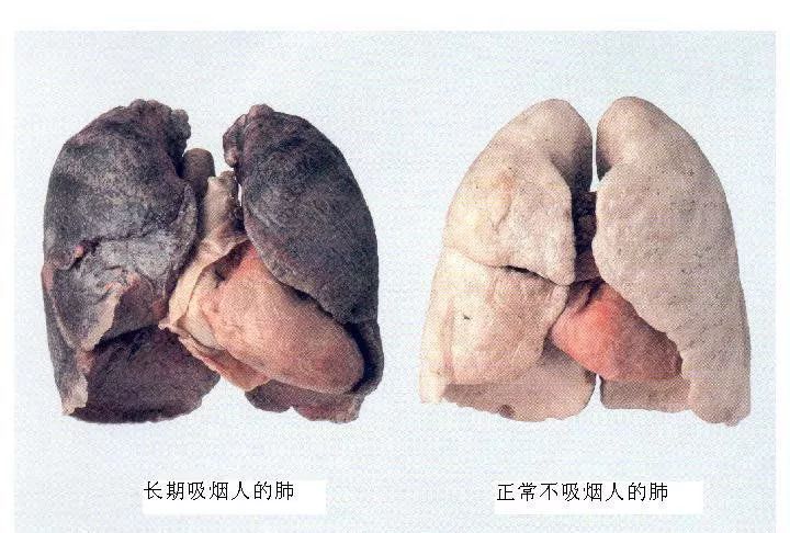 病痛伴烟而生健康随烟而逝,健康随烟而逝