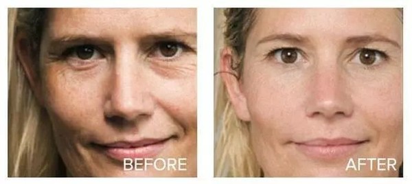 深扒美白成分不可不知的烟酰胺,市面的美白针