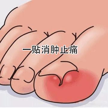 小脚趾甲长在肉里一碰就疼怎么办,指甲扎到肉里怎么处理