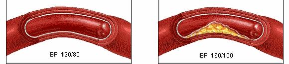 汉麻隐形袜,汉麻袜夏季