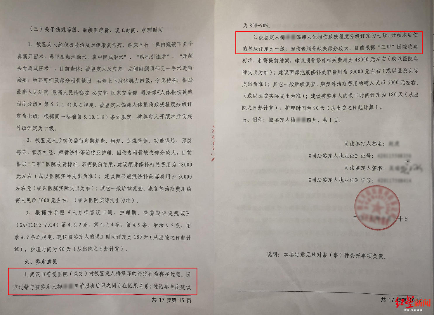 武汉大学生因鼻窦炎手术致智力障碍家长医院陷赔偿僵局