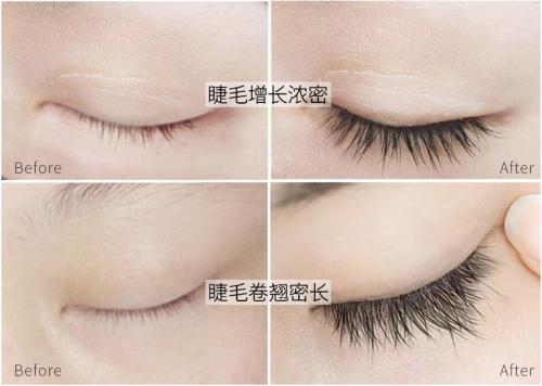 艾赛琳睫毛增长液,爱德兰丝睫毛增长液测评