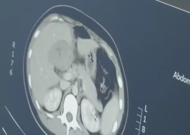 安徽一孕妇子宫竟是空的？孩子去哪了？医生一检查，吓坏了！