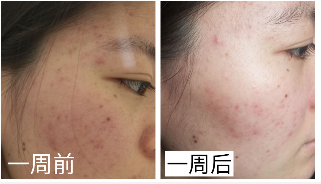 盲测14天揭密|年轻肌特训营收关，那瓶好评如潮的精华水究竟是谁？