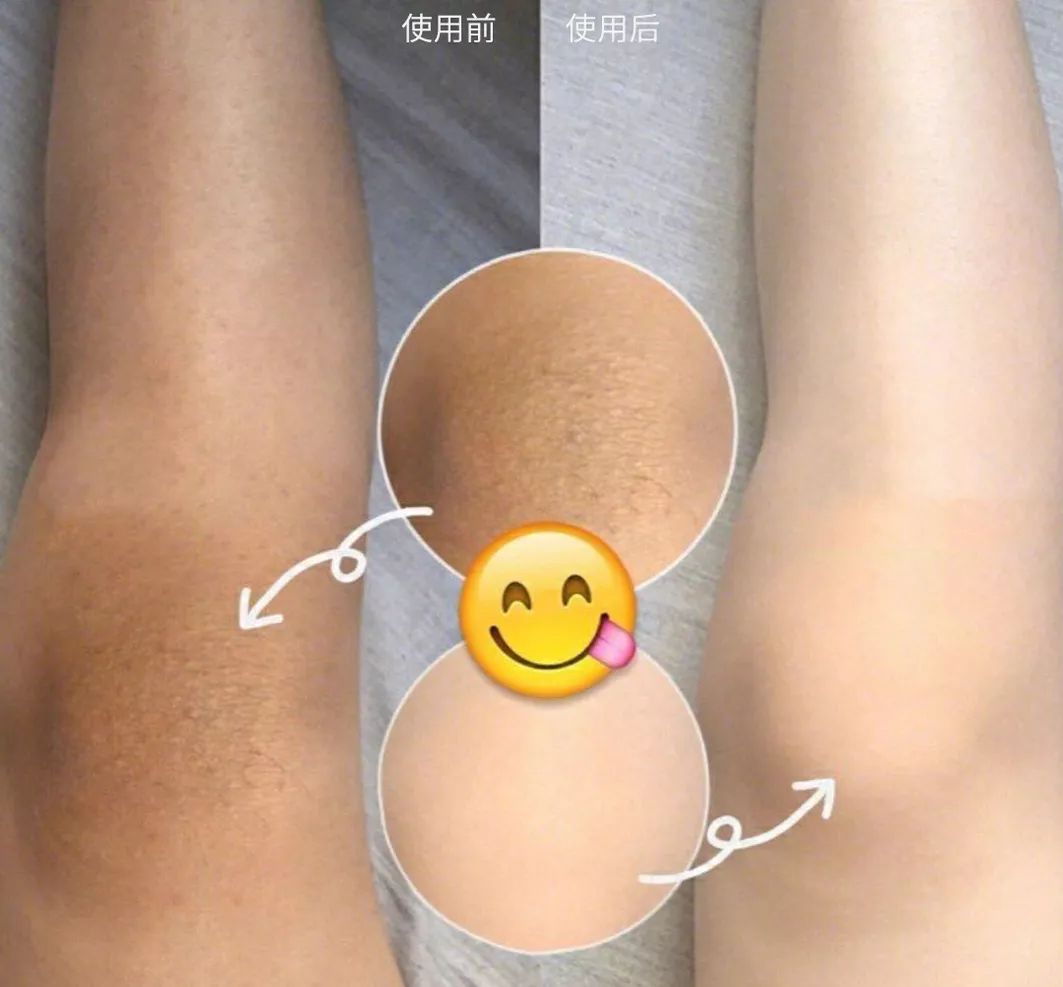 这才是夏天的光腿神器,可以遮腿毛的光腿神器