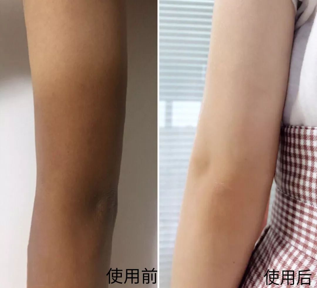 液体*袜丝**是什么鬼？用过的妹子都尖叫！黑腿瑕疵都没了