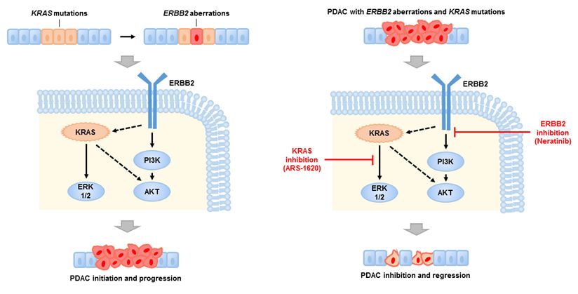 胰腺癌药物研究大突破,胰腺癌靶向药最新研究成果
