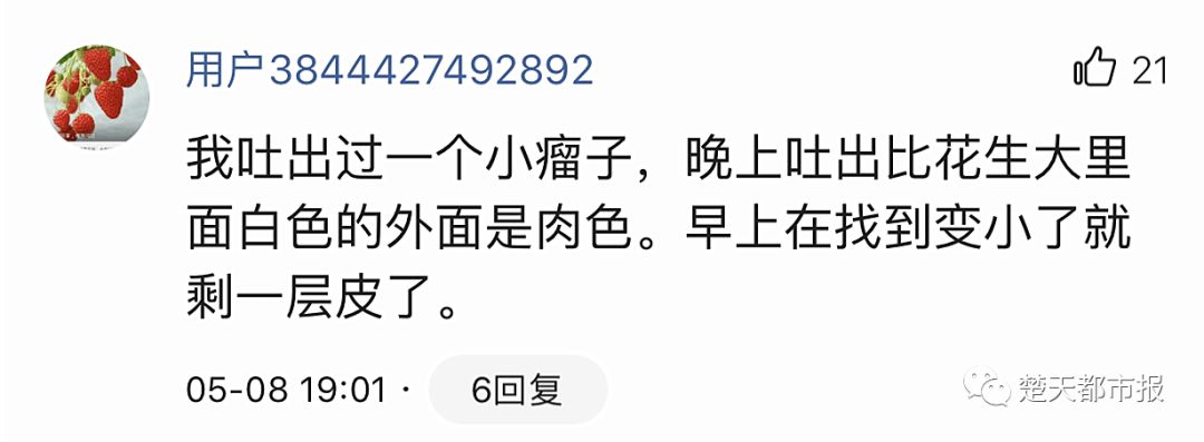 吓人！男子酒后呕吐出大肉团！医生：是肿瘤！更奇葩的是...