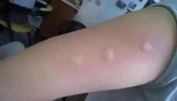 日本蚊子驱蚊神器,夏天灭蚊必备好物