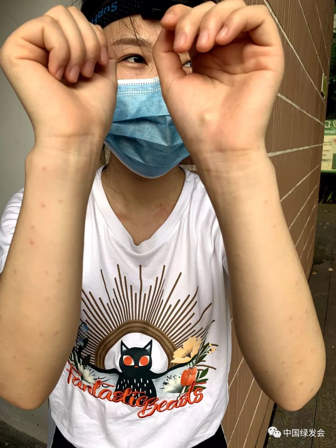 蜱虫黑虫,蜱虫天敌红蚂蚁