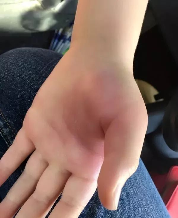 广东下雨后出现的虫子,广东雨后常见的虫子